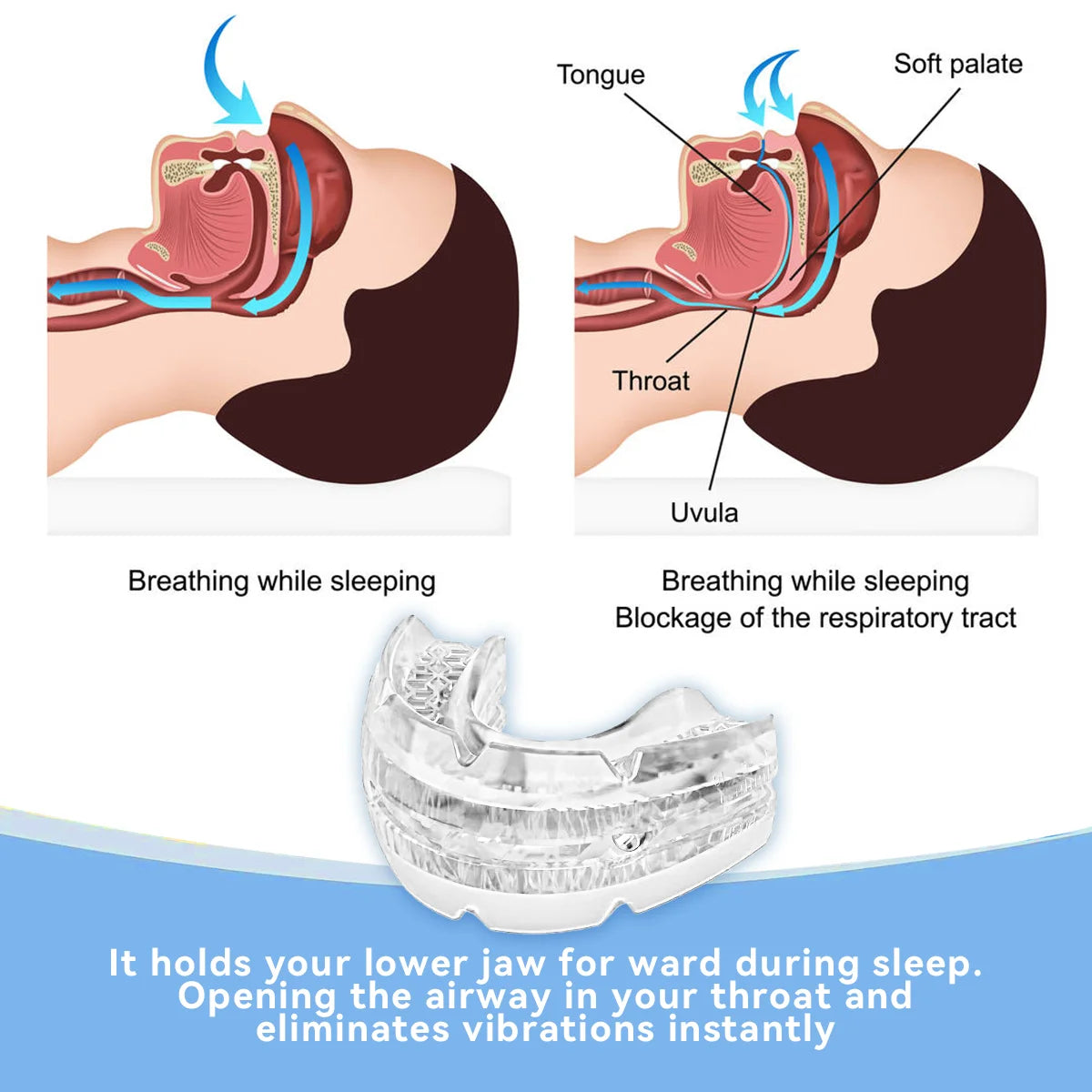 2025 New Adjustable Anti-Snoring Mouth Guard – Sleep Aid for Snoring & Bruxism Relief - Image 5