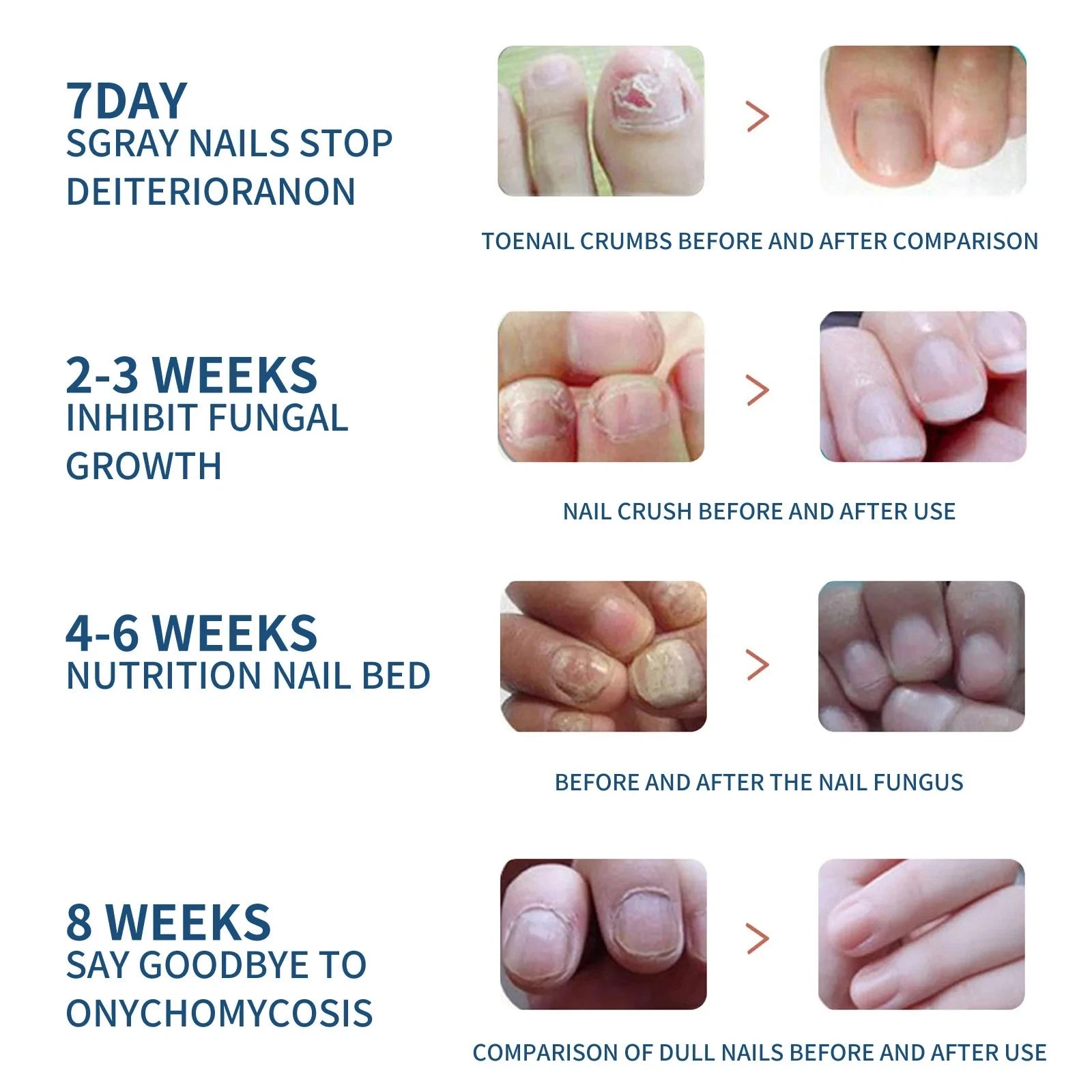 32/64PCS Foot & Nail Repair Patch – Ingrown Toenail & Fungal Treatment Stickers - Image 6