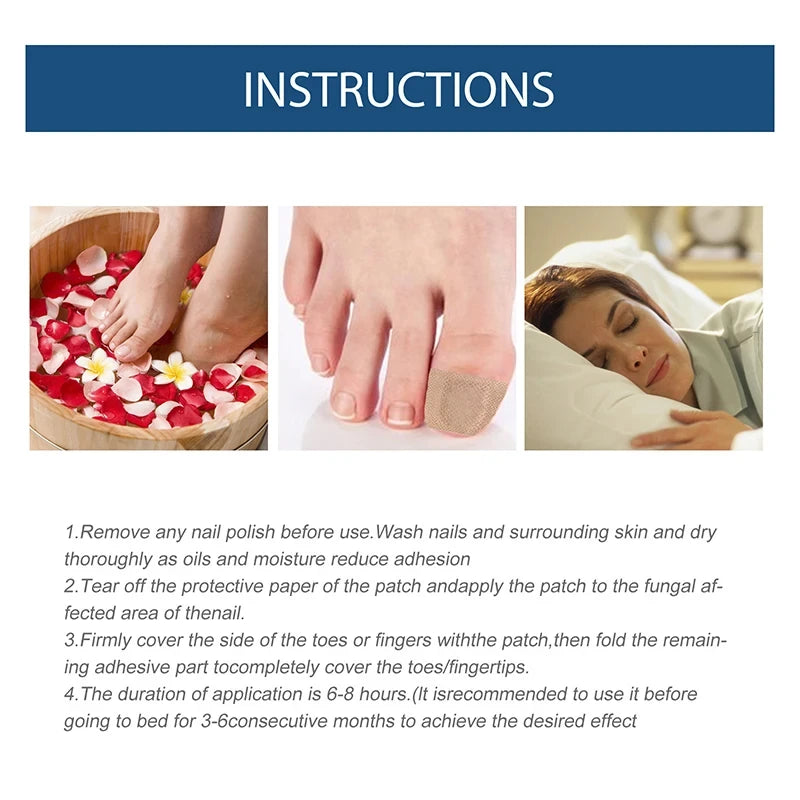 32/64PCS Foot & Nail Repair Patch – Ingrown Toenail & Fungal Treatment Stickers - Image 4